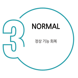 NORMAL